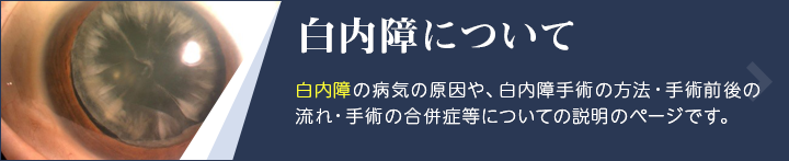 白内障について 白内障の病気の原因や、白内障手術の方法・手術前後の流れ・手術の合併症等についての説明のページです。