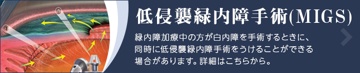 低侵襲緑内障手術(MIGS) 緑内障加療中の方が白内障を手術するときに、同時に低侵襲緑内障手術をうけることができる場合があります。詳細はこちらから。